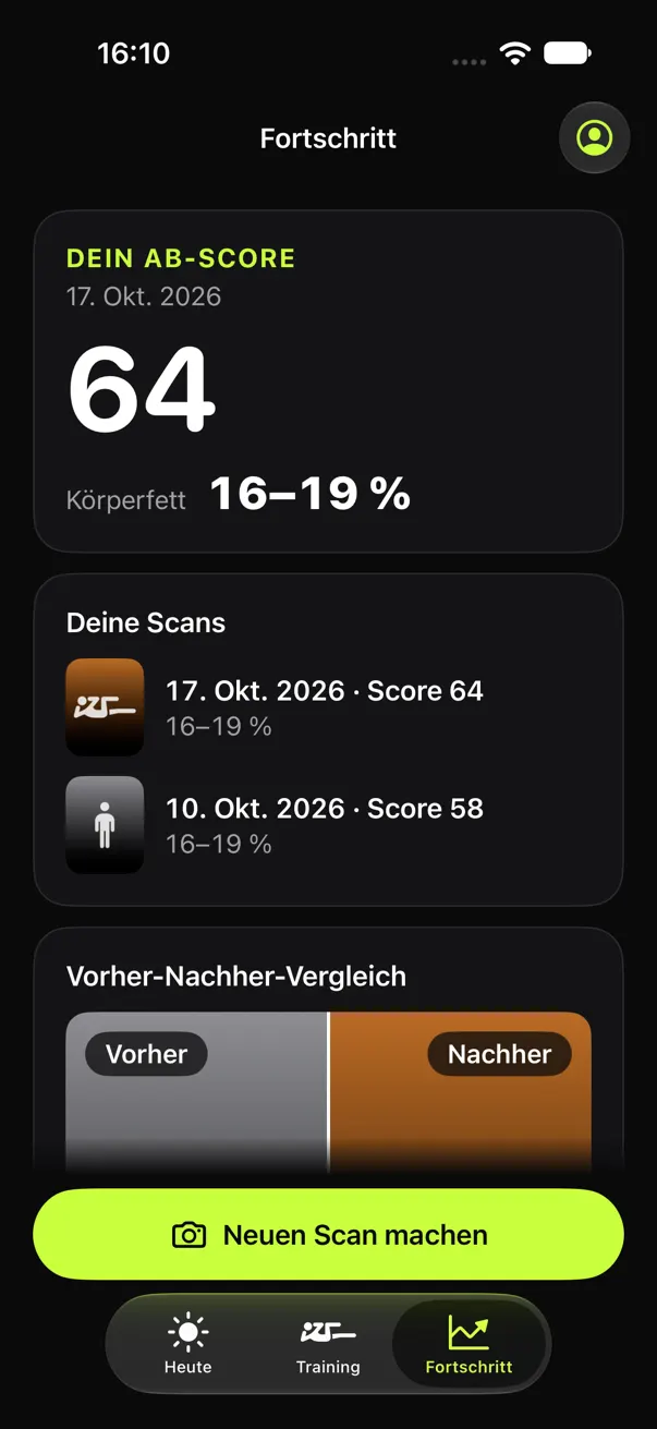 Fortschritt-Tab von AbPeak mit Ab-Score, Scan-Verlauf und Vorher-Nachher-Vergleich